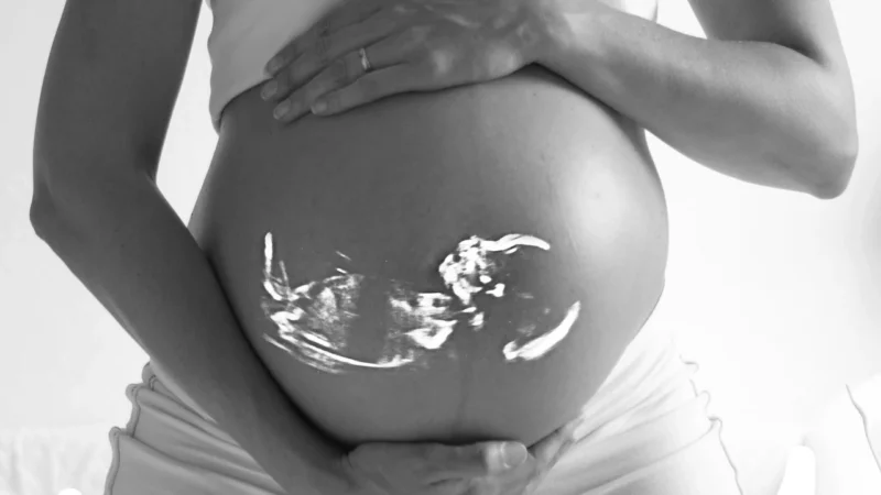 Koarktacja aorty u płodu – wczesna diagnoza lepszej przyszłości dziecięcego serca