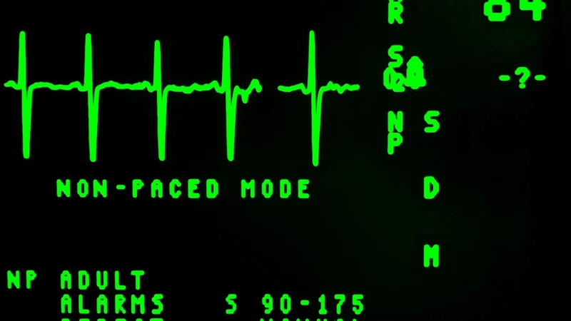 Vitalograph Aparat Ekg 12-Lead Bluetooth Ecg For Scandinavia Z